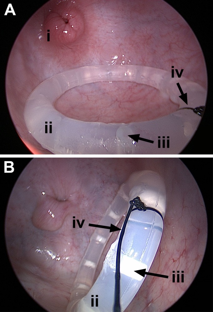 FIG 2