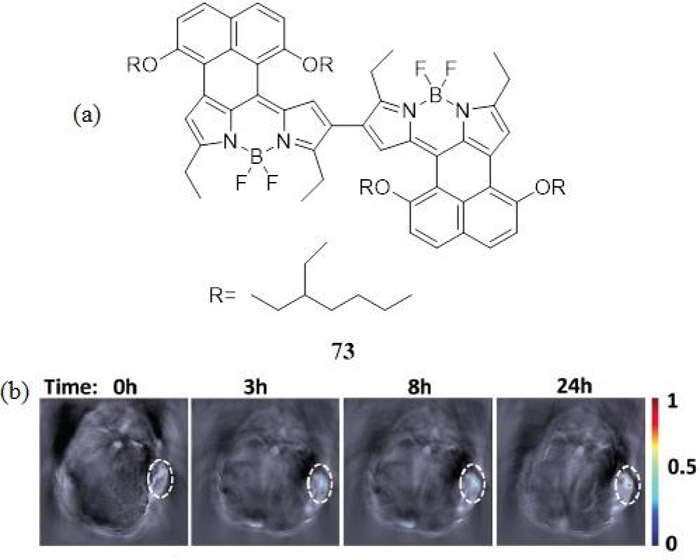 Figure 35.