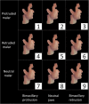 Fig. 4