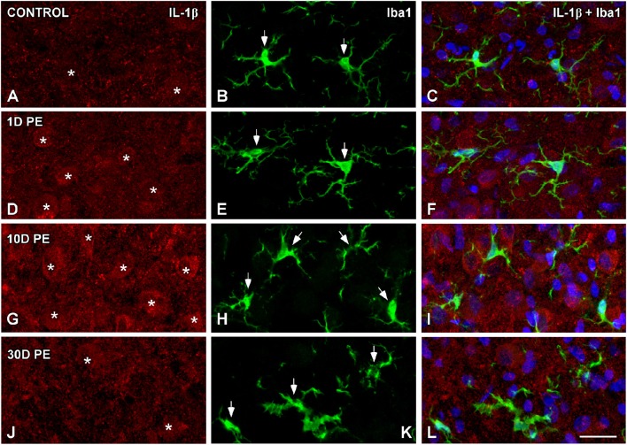 Figure 14