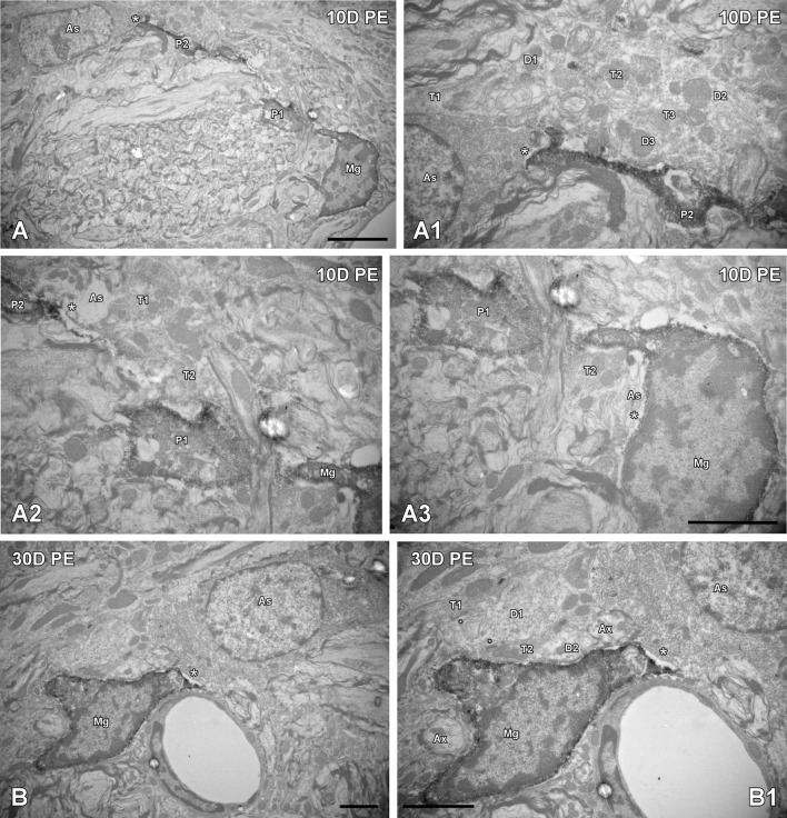 Figure 11