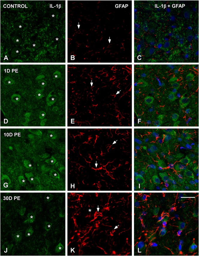 Figure 15