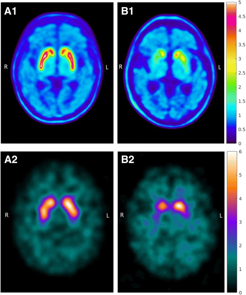 Fig. 1