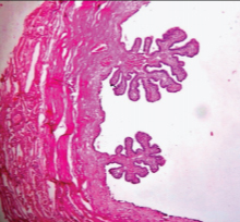 [Table/Fig-4b]: