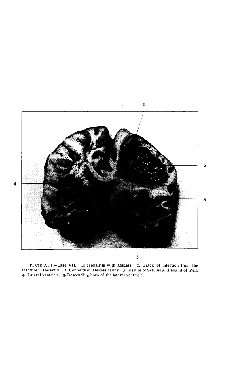 502-4