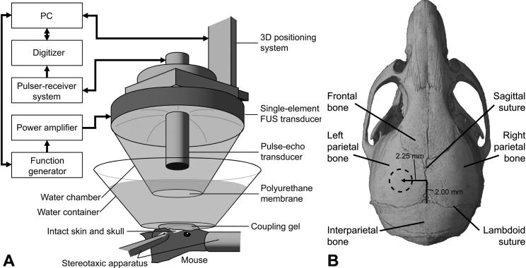 FIG. 1