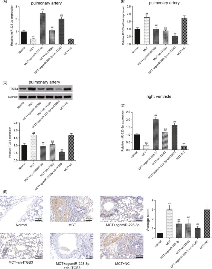 Figure 14