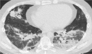graphic file with name fx3_lrg.gif