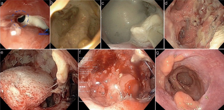 Fig. 6