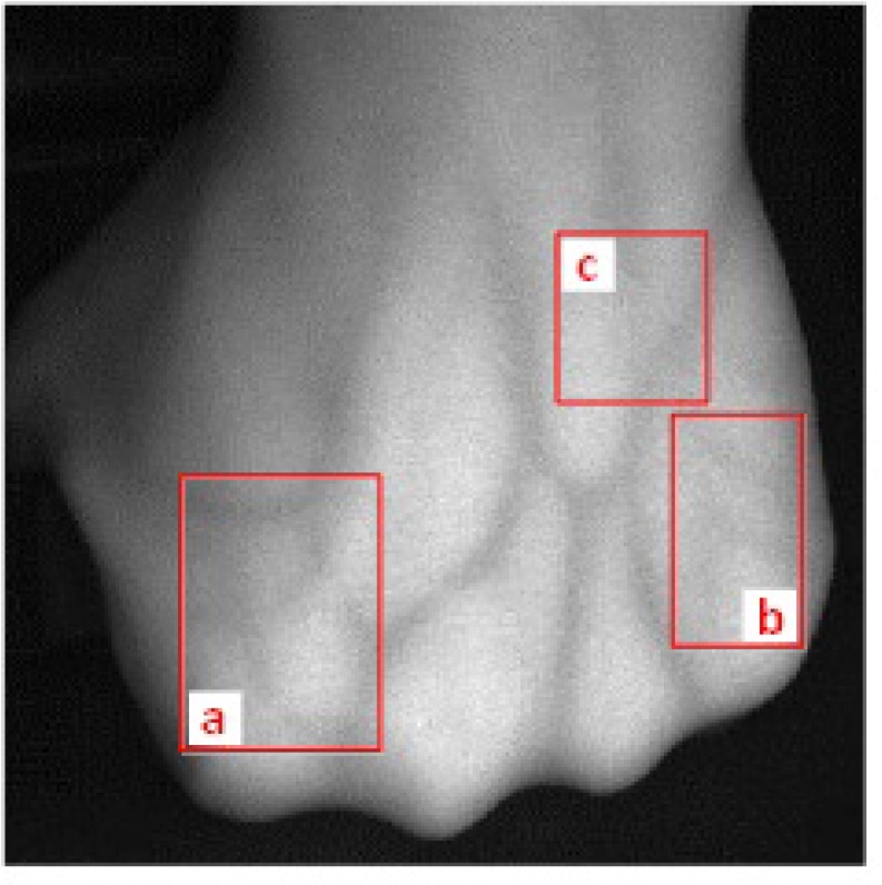 Fig. 12