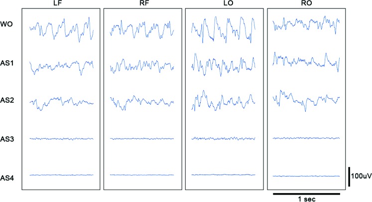 FIG. 2.