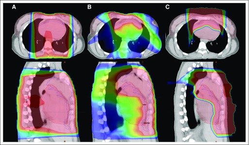 Fig 3.