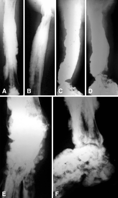 Fig. 3A–F