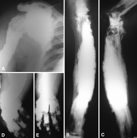 Fig. 2A–E