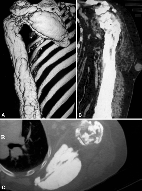 Fig. 4A–C