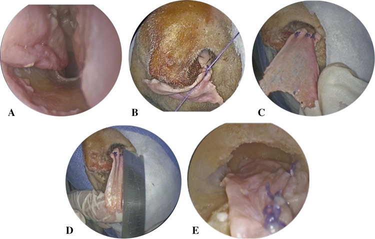 Fig. 2