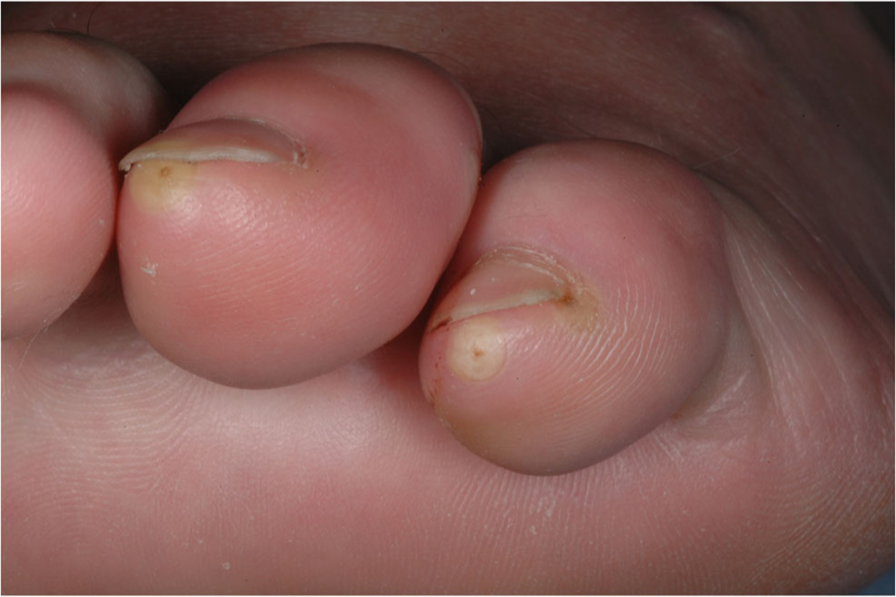 Fig. 10