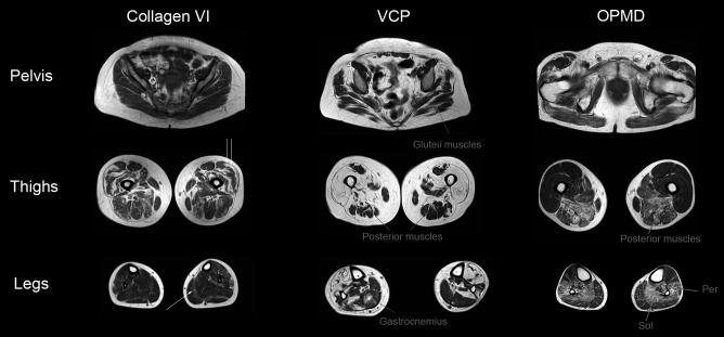 Figure 11.