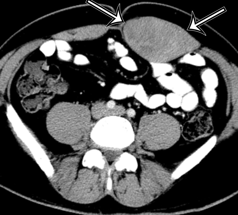 Figure 11a.