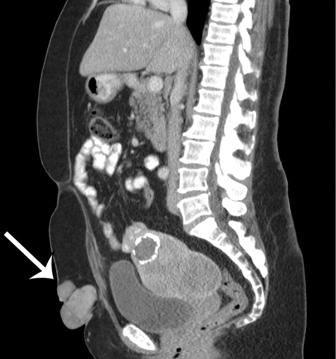 Figure 3b.