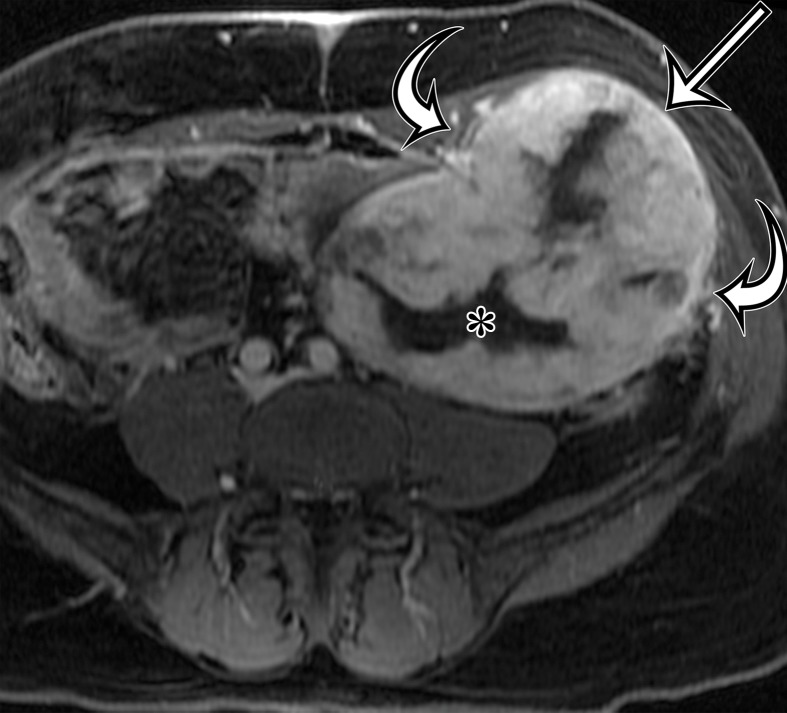 Figure 10c.