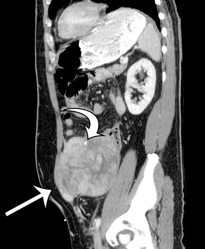 Figure 10b.