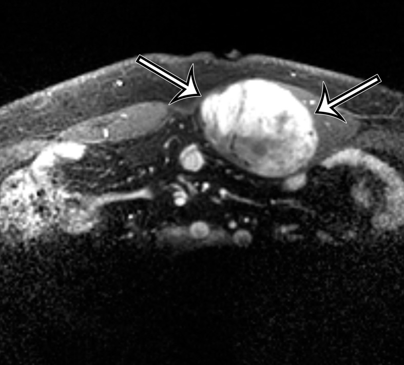 Figure 11c.