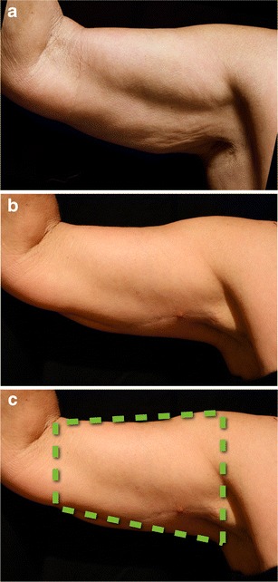 Fig. 19