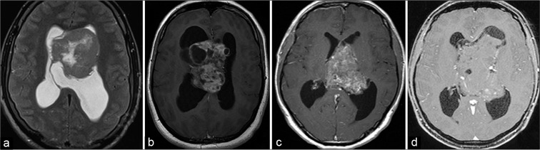 Figure 1: