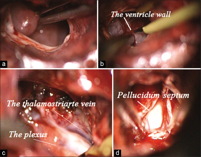 Figure 2: