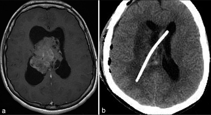 Figure 3: