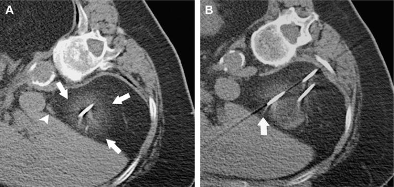 Fig. 10