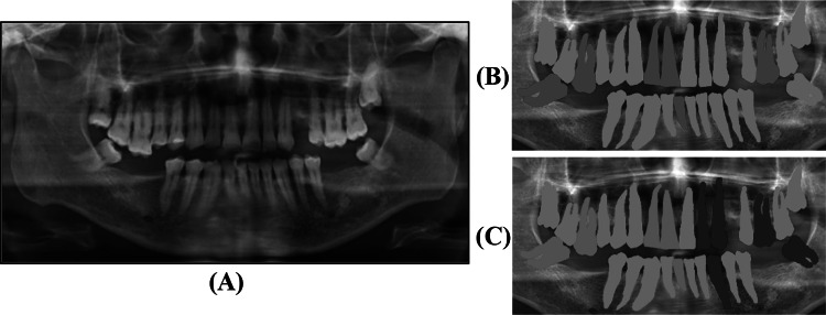 Fig. 4