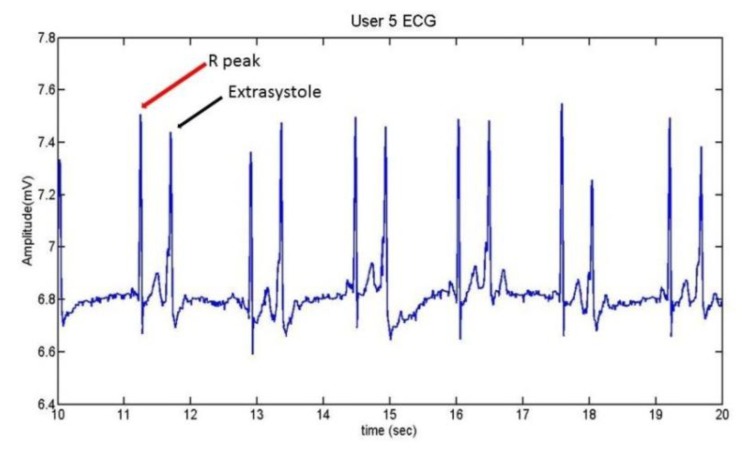 Figure 21.