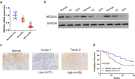 mRNA and protein levels of NEDD4L were low in OSCC tissues, and patients with high NEDD4L expression had a much higher 5-year survival rate than patients expressing low-level NEDD4L (p < .05).