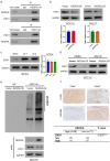 NEDD4L bound to ENO1 and induced its ubiquitination, and a negative correlation between NEDD4L and ENO1 expression levels were observed in OSCC samples.