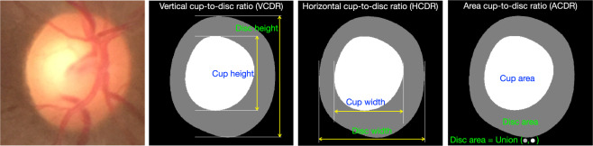 Fig. 1
