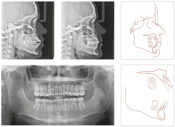 Figure 14