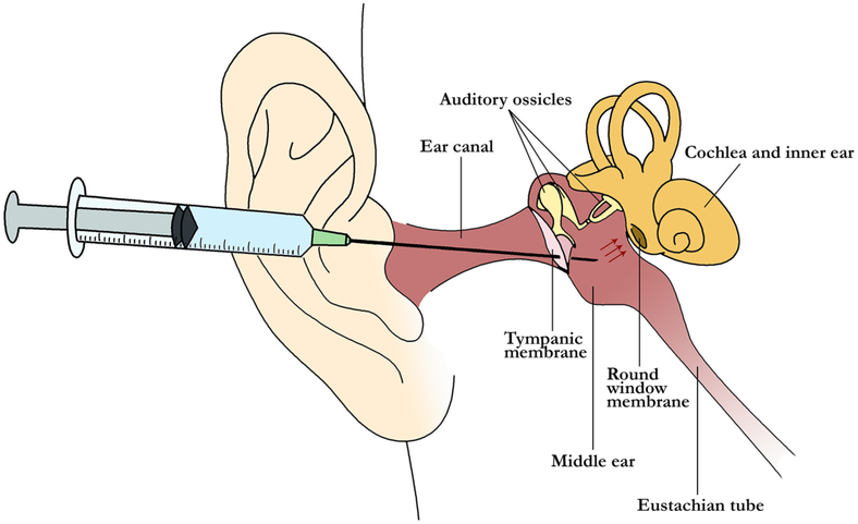 Figure 1: