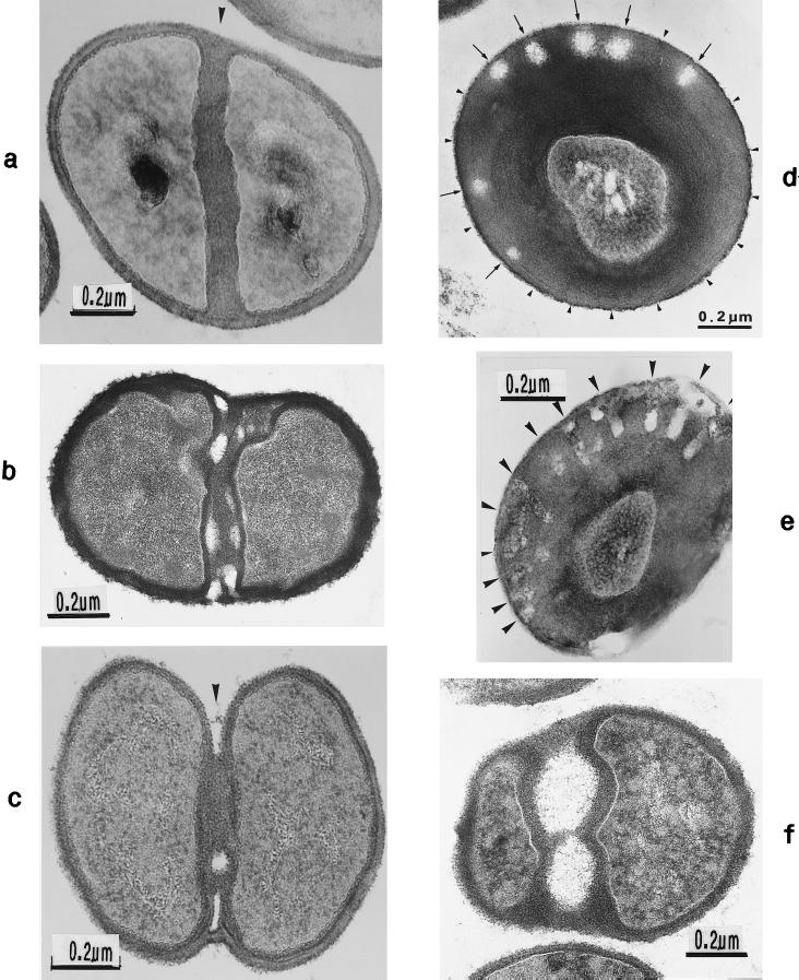 FIG. 14