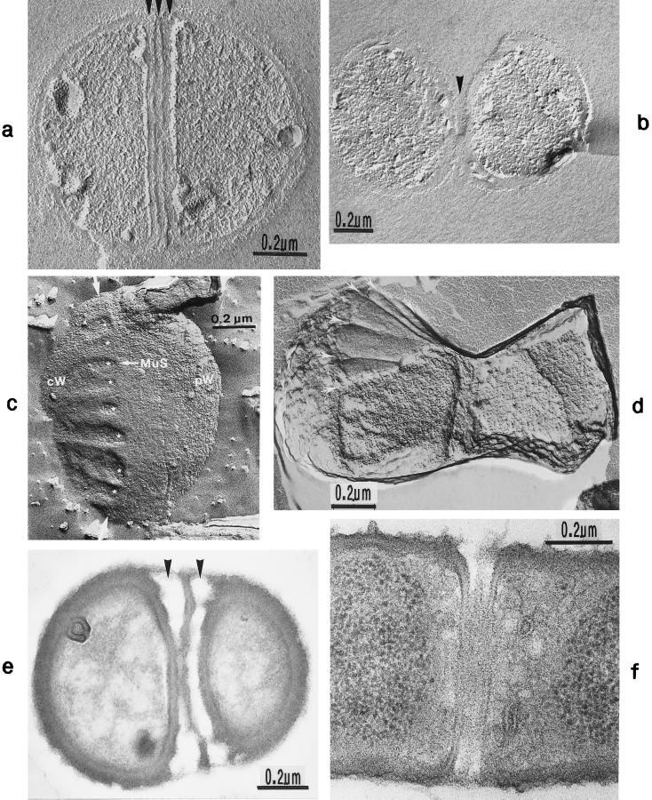 FIG. 11