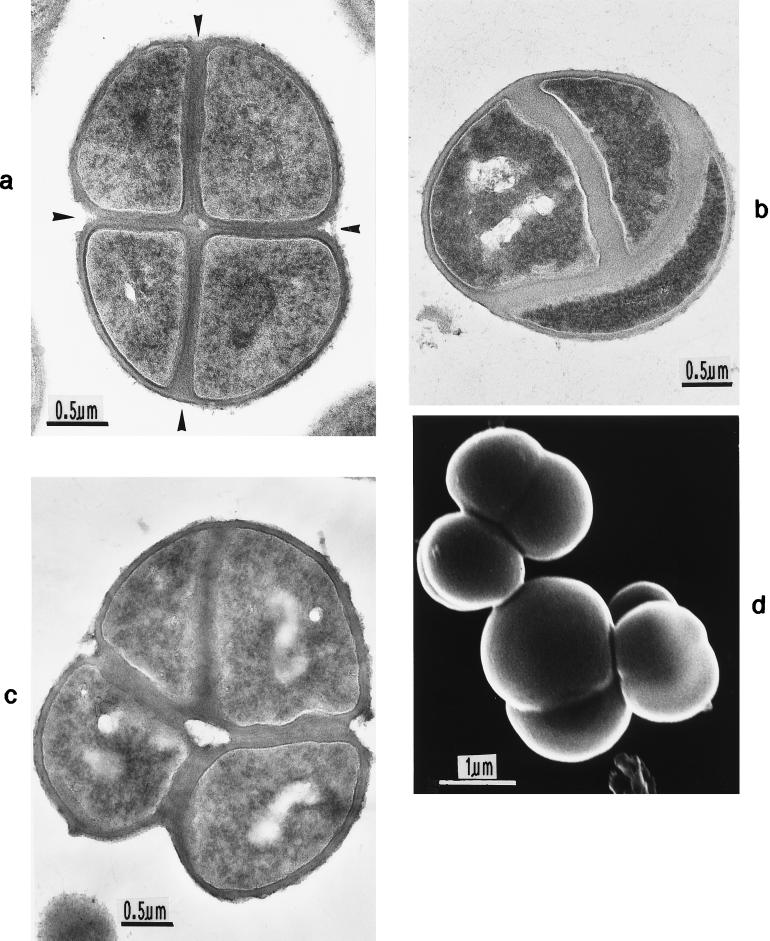 FIG. 15