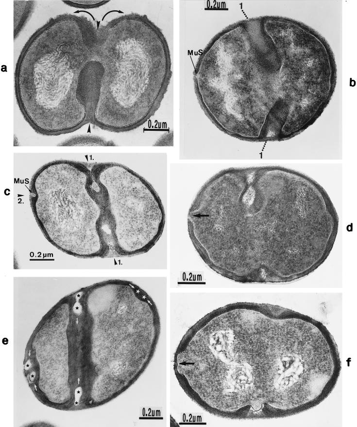 FIG. 19