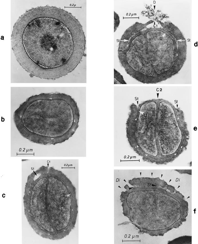 FIG. 16