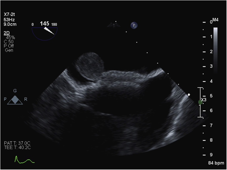 Figure 3