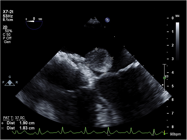 Figure 2