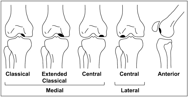 Fig. 11