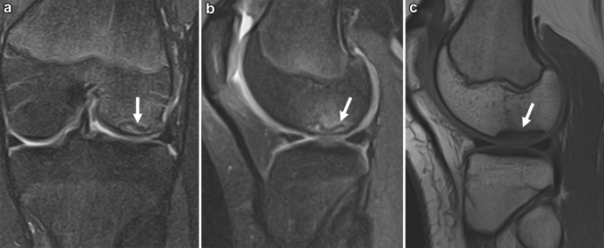 Fig. 12