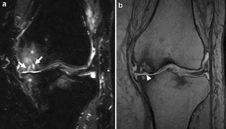 Fig. 14