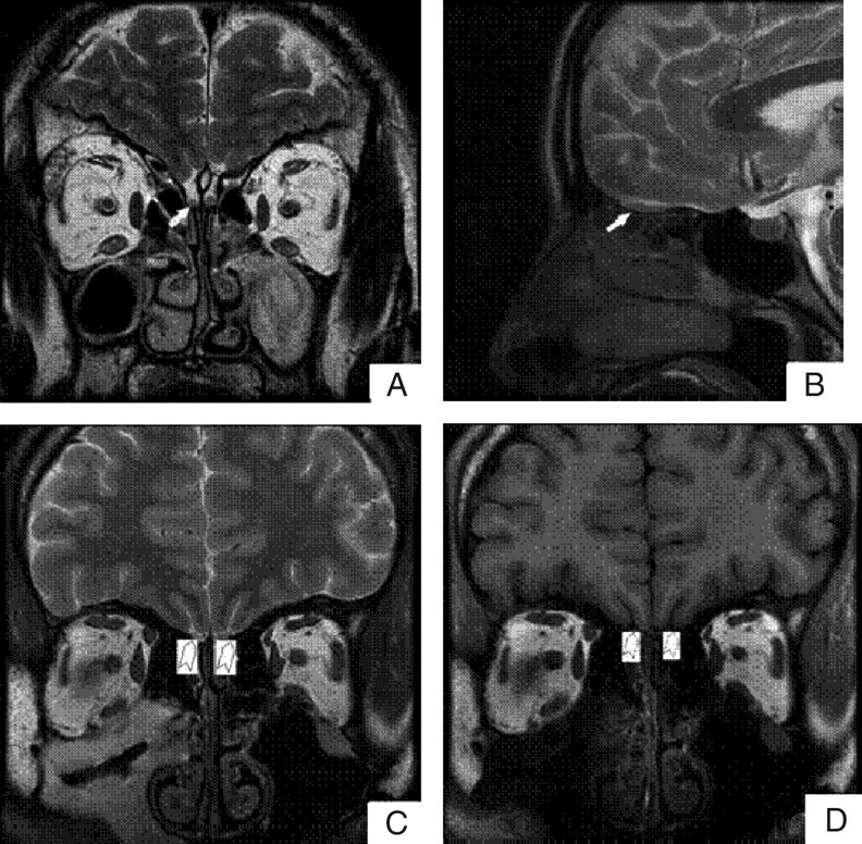 Fig 1.